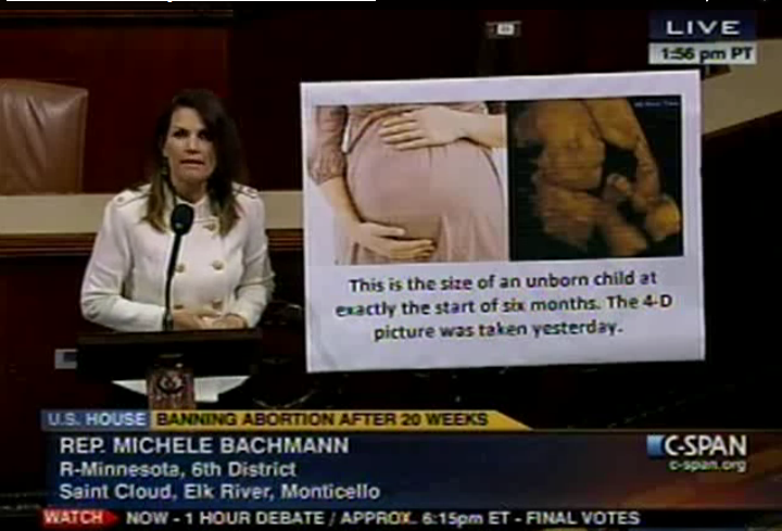 Michele Bachmann uses picture of the Valentine's Baby, when on the House floor debating the Pain-Capable Act