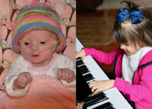 Melody: A Joyful, Musical Girl With Trisomy 18