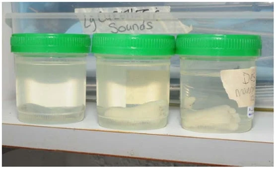 Three clear plastic jars with green lids, each containing a preserved specimen submerged in clear liquid, are displayed on a shelf. Handwritten labels are visible—reminiscent of the evidence shown during Kermit Gosnell’s media coverage as a convicted murderer.