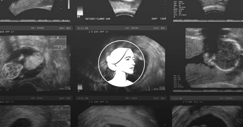 A collage of ultrasound images in grayscale features a white circular icon of a woman’s face outlined in the center, set against sonogram scan details—symbolizing ongoing discussions like the SBA to Senate House debates on defunding big abortion.