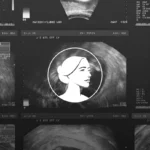 A collage of ultrasound images in grayscale features a white circular icon of a woman’s face outlined in the center, set against sonogram scan details—symbolizing ongoing discussions like the SBA to Senate House debates on defunding big abortion.